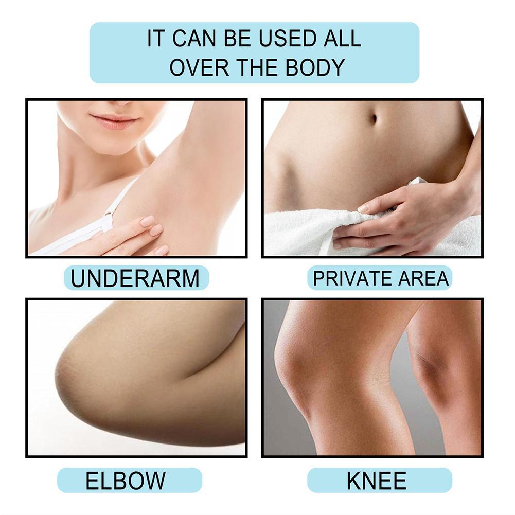 Kem Dưỡng Trắng Da Vùng Dưới Cánh Tay/Đầu Gối/Vùng Bikini Hiệu Quả O9Q5