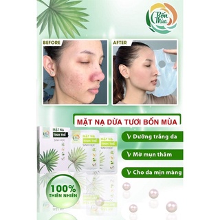 Combo 5 hộp nạ dừa sinh học