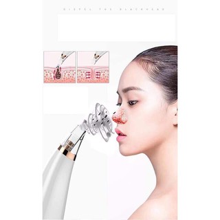 Máy hút mụn tự động Black Head Detector