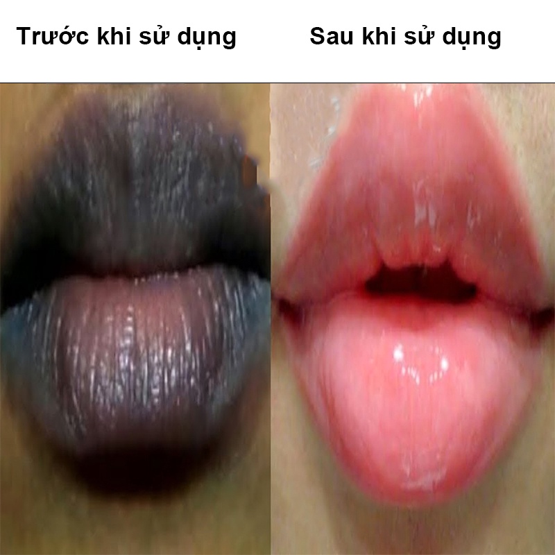 【Thâm môi】mặt nạ môi, kem môi, chăm sóc vùng môi, tinh chất chăm sóc trẻ hóa môi, dưỡng ẩm môi, phục hồi môi khô nứt