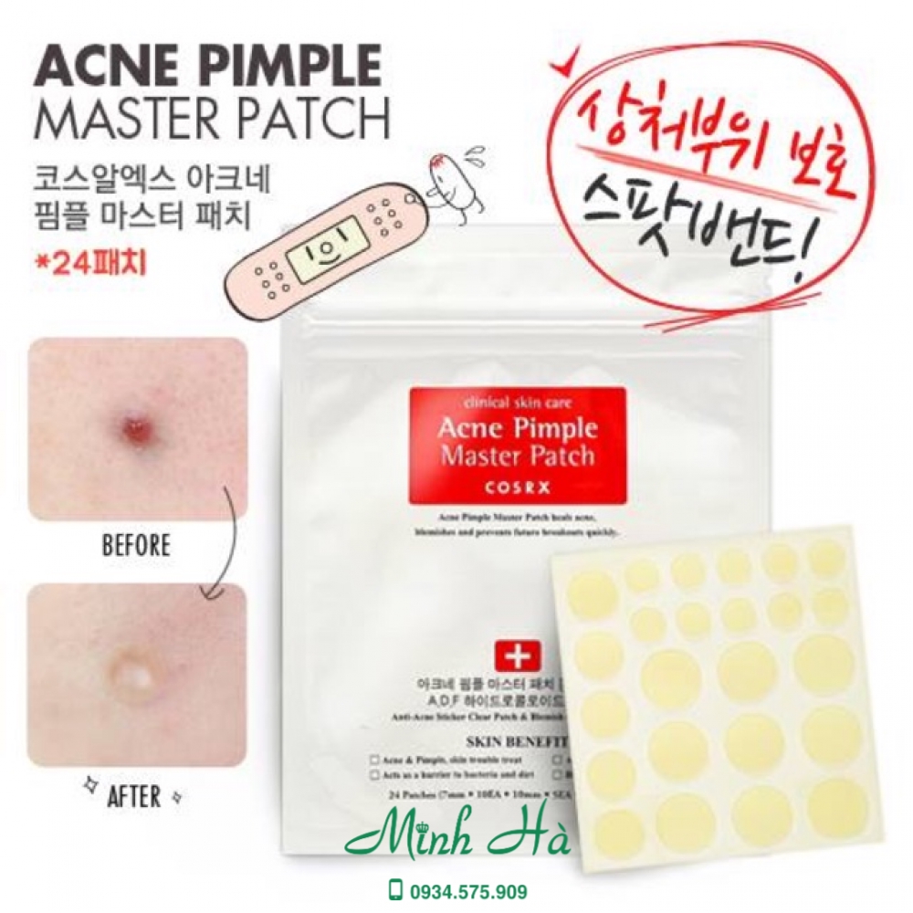 Miếng dán mụn Cosrx Acne Pimple Master Patch