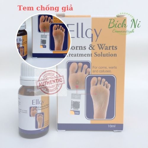 Dung dịch Ellgy Corns &amp; Warts loại sạch mụn cóc, mụn cơm, chai mắt cá chân.