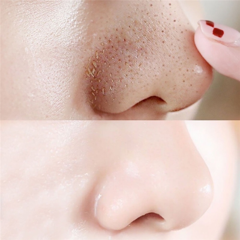 Mặt Nạ Mũi Lột Mụn Đầu Đen Làm Sạch Sâu Se Khít Lỗ Chân Lông