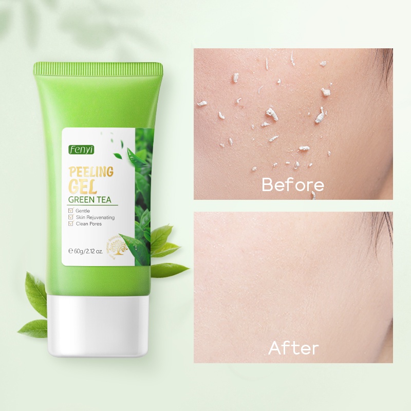 Gel tẩy tế bào chết FENYI chiết xuất trà xanh tẩy mụn đầu đen làm sạch lỗ chân lông hiệu quả chuyên dụng 60g