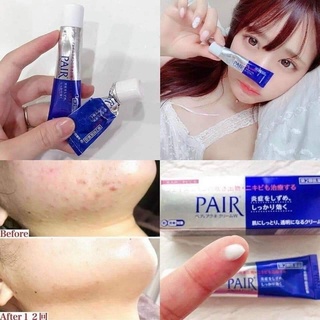 Chấm mụn pair nhật