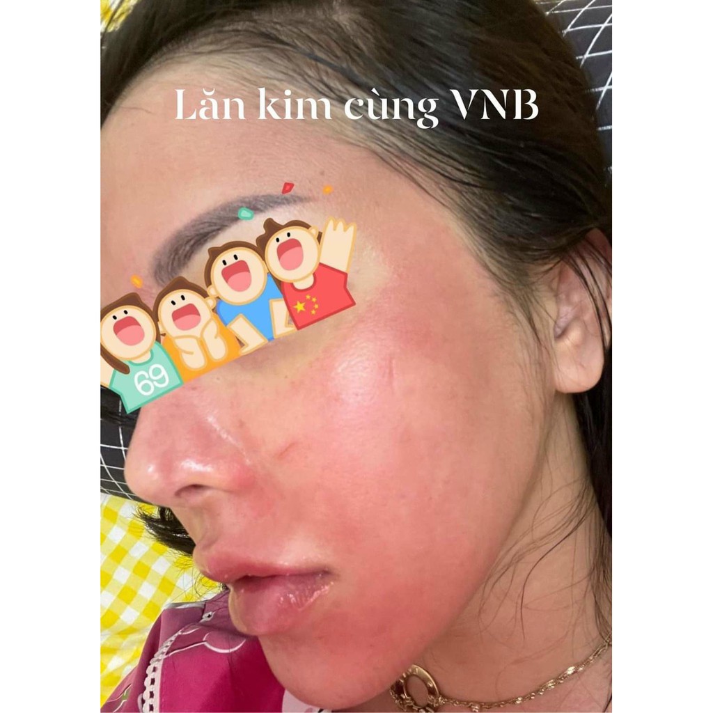 [chính hãng] SERUM CẤP ẨM GIÚP PHỤC HỒI DA 𝐒𝐀𝐋𝐌𝐎𝐍 𝐃𝐎𝐔𝐁𝐋𝐄 𝐄𝐅𝐅𝐄𝐂𝐓 𝐄𝐒𝐒𝐄𝐍𝐂𝐄 VNB