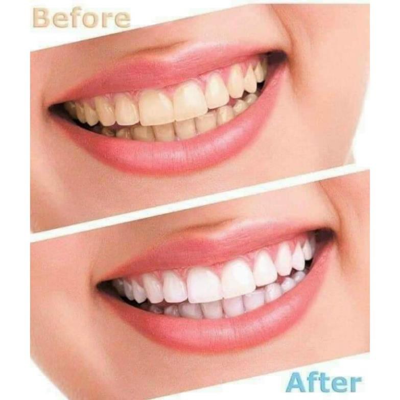 Bột trắng răng Eucryl Đánh Sạch Hết Vết Ố