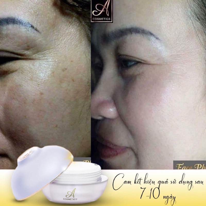 (Chính hãng) kem face Pháp A cosmetics dưỡng dạ trắng mịn hết mụn nám sạm