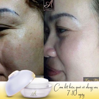 Kem dưỡng trắng da Face Pháp Acosmetics