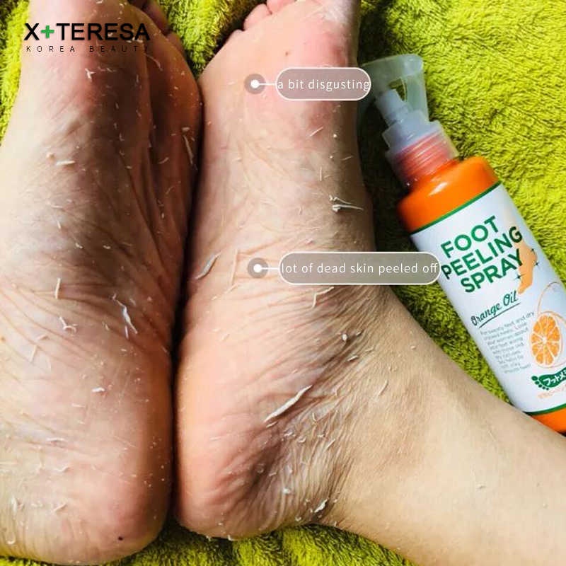 Tẩy Tế Bào Chết Chân, Khuỷu Tay, Đầu Gối Dạng Xịt Foot Peeling Spray Orange Oil