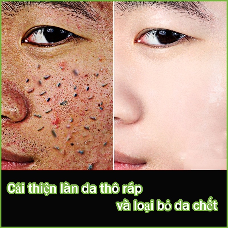 Kem tẩy tế bào chết da mặt tẩy tế bào chết body làm mới Làm mềm mịn Nhẹ nhàng Làm dịu Tăng tốc trẻ hóa da