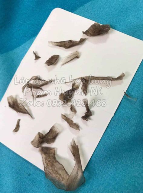 Body Active Peel 50ml: Peel hồng nhũ hoa và cô bé