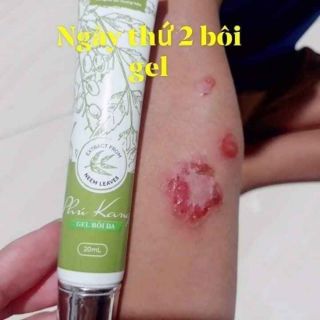 Gel Bôi Da Phú Kang