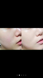 Phấn nước BB Thái Lan