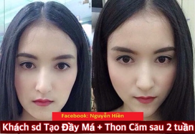 Tinh chất thon hàm má, thu xương quai hàm, hạ gò má cao | BigBuy360 - bigbuy360.vn