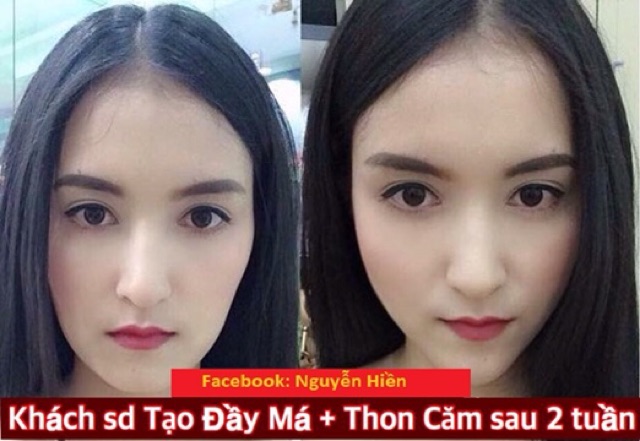 [ BÁN CHẠY NHẤT ] Tinh chất thon hàm má V-line Pháp - Hiệu quả chỉ sau 14 ngày