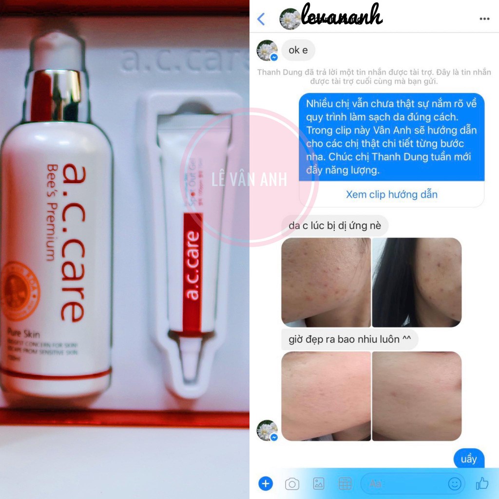 Nước hoa hồng giúp cân bằng da và dưỡng ẩm sâu từ nọc ong AC Care Bee's Premium Pure Skin 130ml