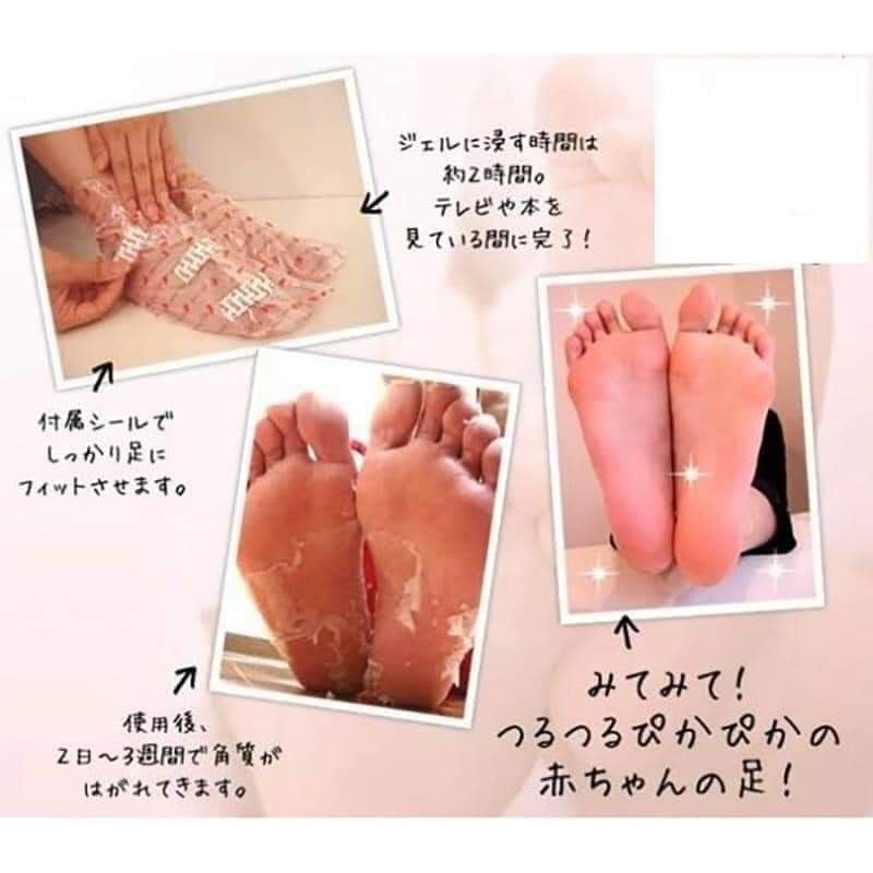 [Chuẩn Nhật] Túi ủ tẩy tế bào chết da chân, bong da chân Nhật Bản - Lavender Foot, Mino Foot - Giảm nứt gót, mịn da chân