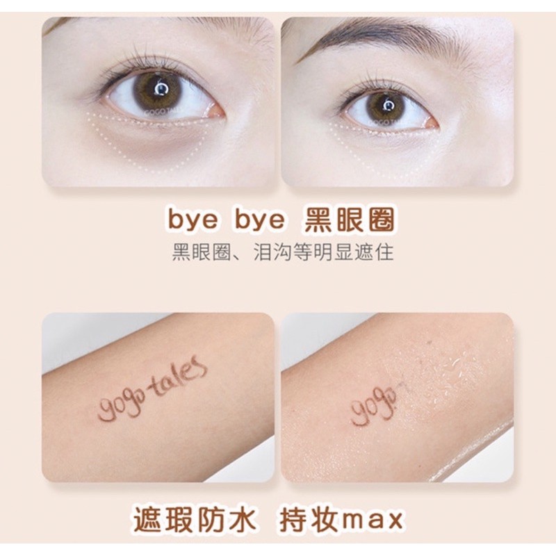 KEM CHE KHUYẾT ĐIỂM GOGOTALES | BigBuy360 - bigbuy360.vn