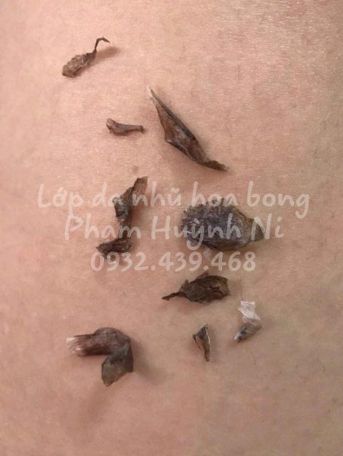 Body Active Peel 50ml: Peel hồng nhũ hoa và cô bé