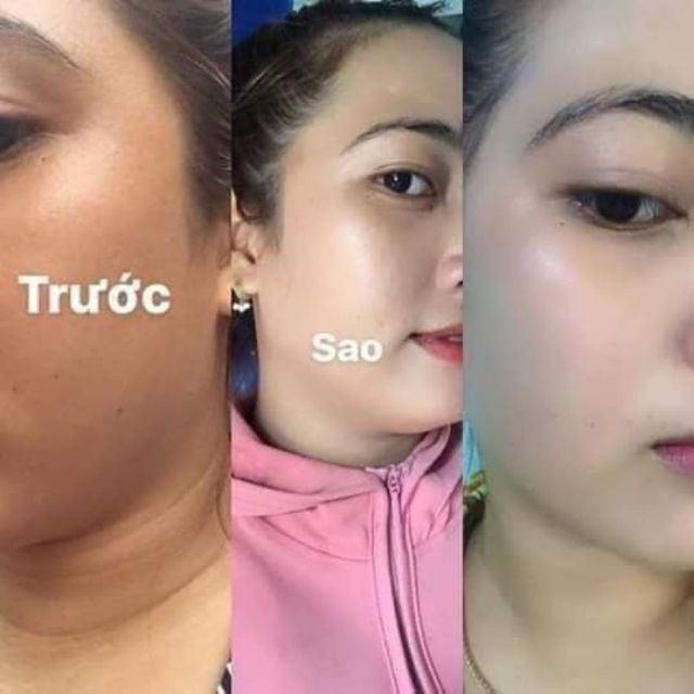  Kem KONE THÁI LAN MẪU MỚI 2021 | BigBuy360 - bigbuy360.vn