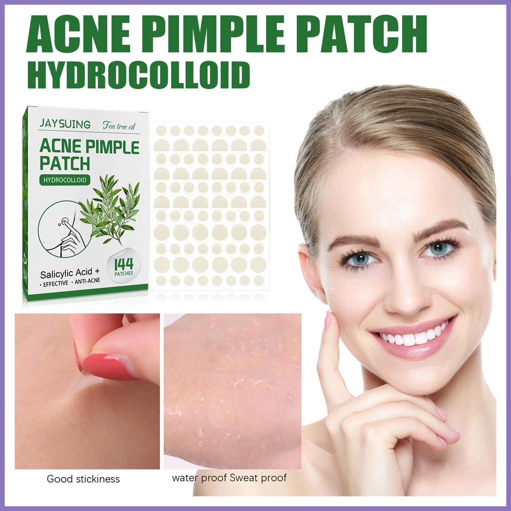 Miếng Dán Trị Mụn Vô Hình 144 Miếng nota2vn