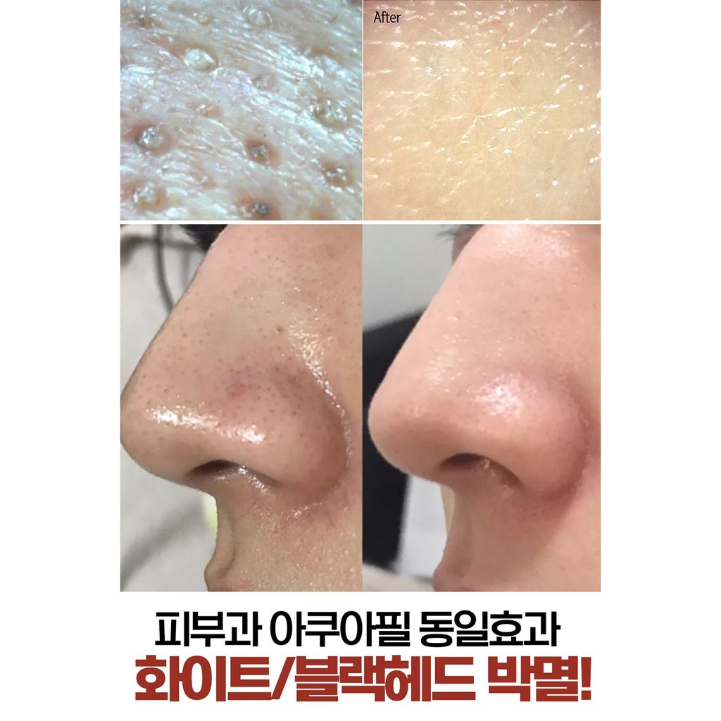 (Hàng Mới Về) Bút Tẩy Tế Bào Chết Chiết Xuất Bưởi G9Skin 23g