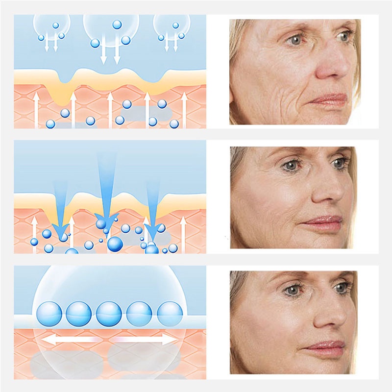 Kem Dưỡng Da Mặt 20g Chứa Retinol Chống Lão Hóa Xóa Mờ Nếp Nhăn Làm Trắng Da Dưỡng Ẩm