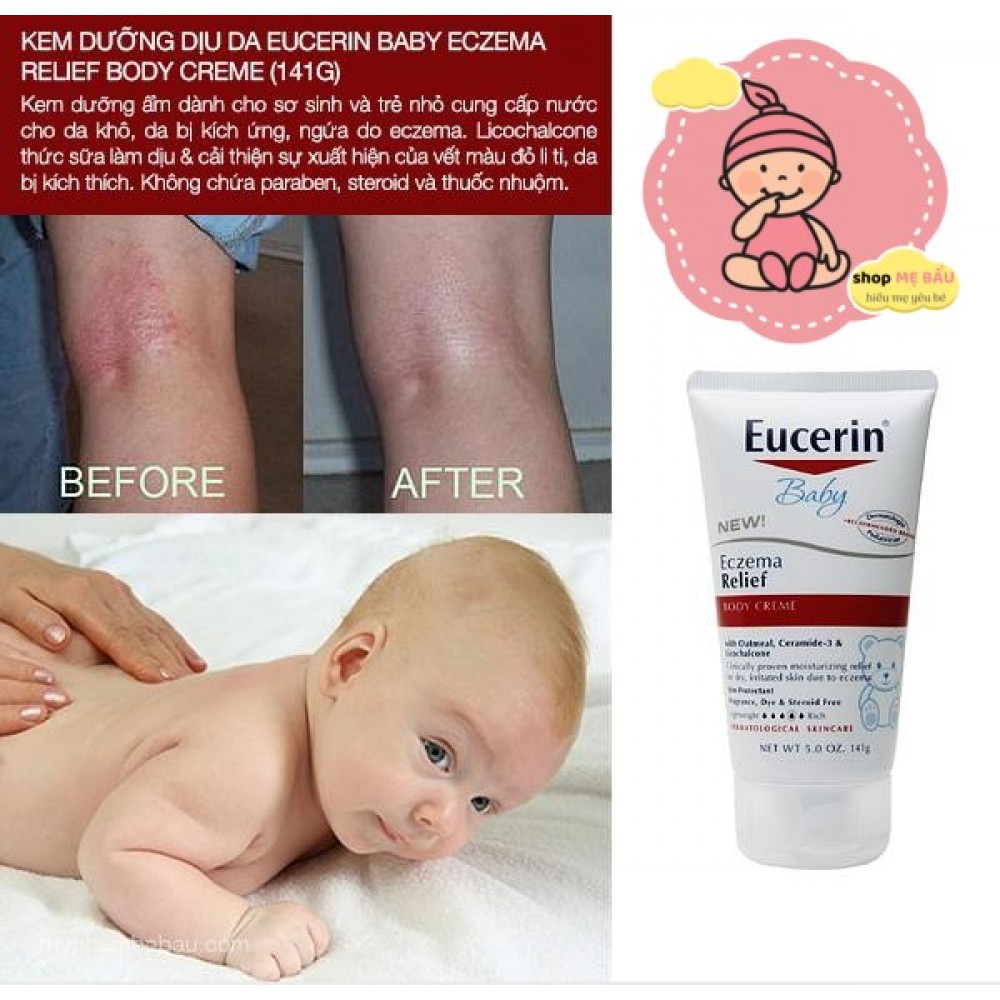 Kem giảm chàm Eucerin Eczema Relief cho bé từ 3 tháng và người lớn.