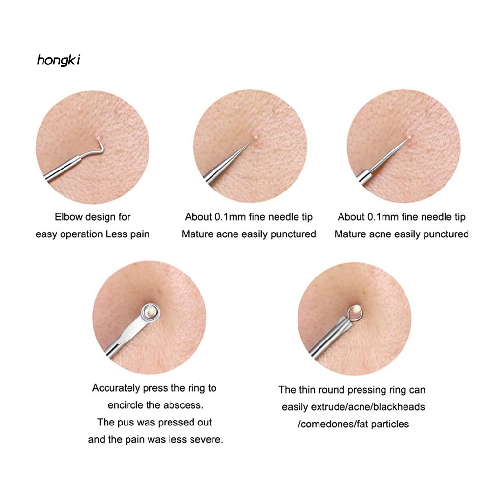 Set 4 Dụng Cụ Nặn Mụn Thân Thiện Với Da