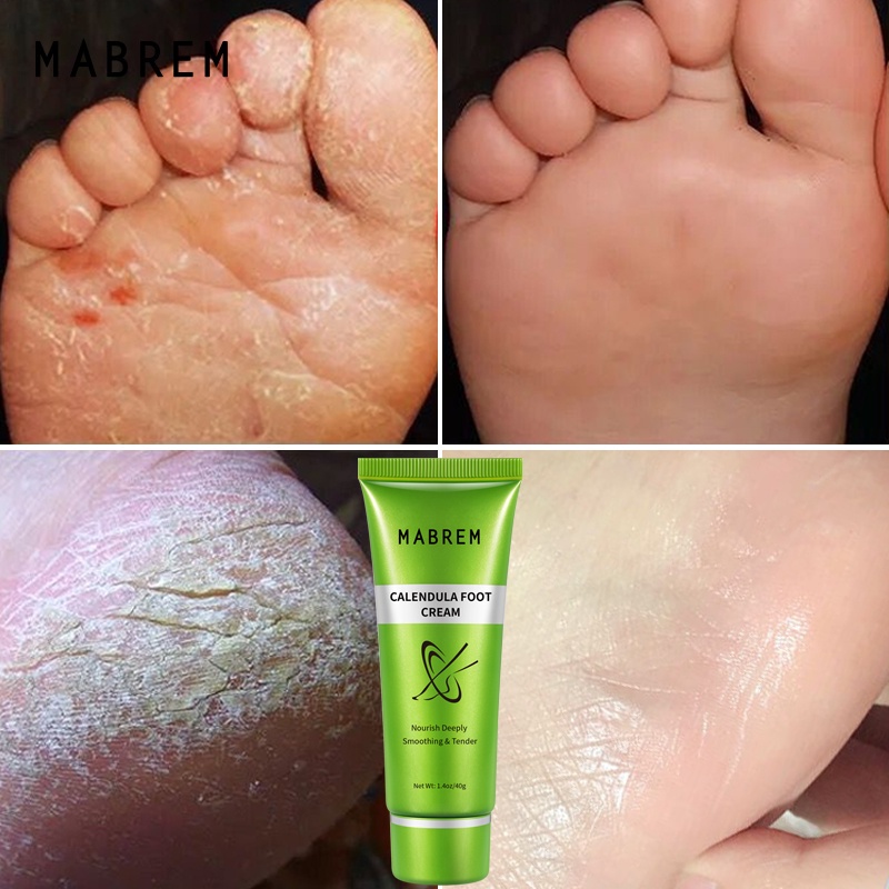 Kem Dưỡng Da Chân MABREM Chiết Xuất Ô Liu Tẩy Tế Bào Chết Chống Khô Nứt Nẻ 40g