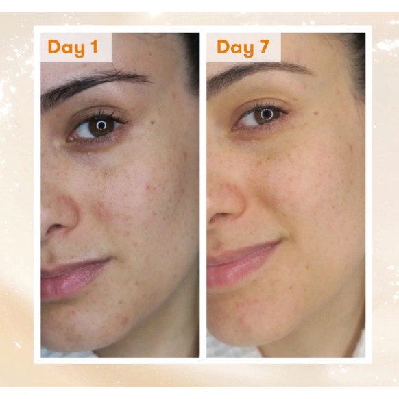 Kem dưỡng đêm sáng da mờ thâm nám Ren Overnight Glow Dark Spot Sleeping Cream 10ml