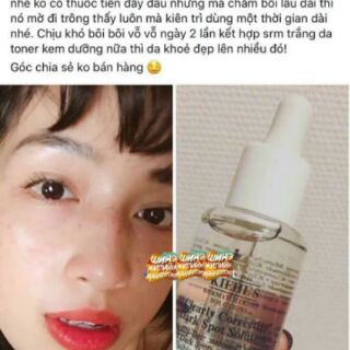 Serum kiehl's. Nám, tàn nhang