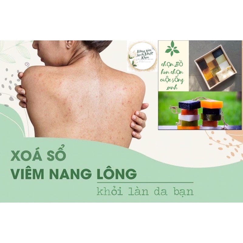 Xà Bông Sinh Dược giảm thâm, mụn lưng-100% thành phần thiên nhiên Handmade (tặng túi lưới tạo bọt) | BigBuy360 - bigbuy360.vn