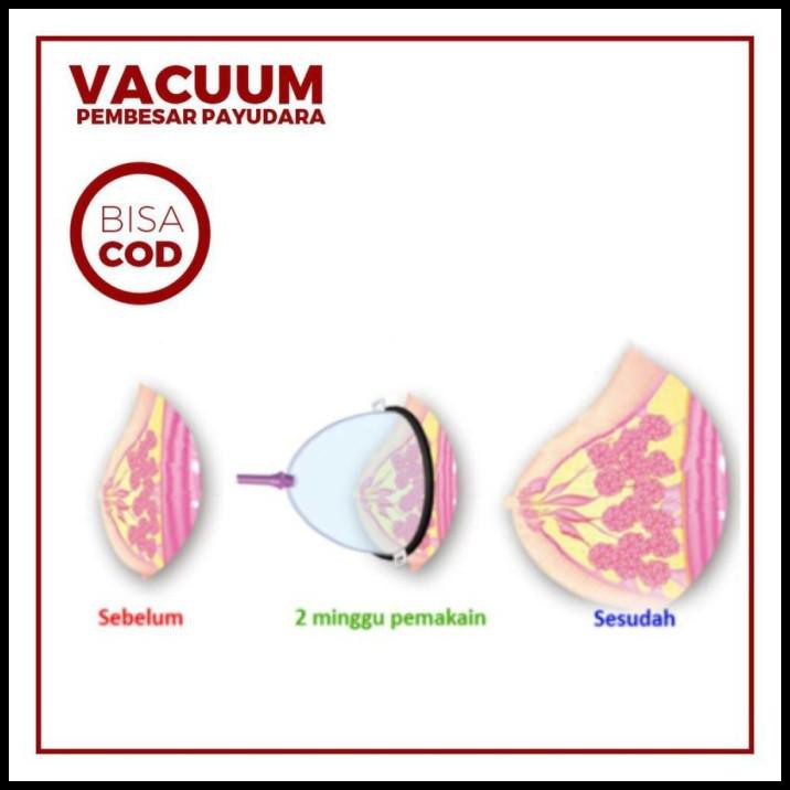 Máy Hút Sữa Tăng Kích Thước Vòng Một Cho Nữ | BigBuy360 - bigbuy360.vn