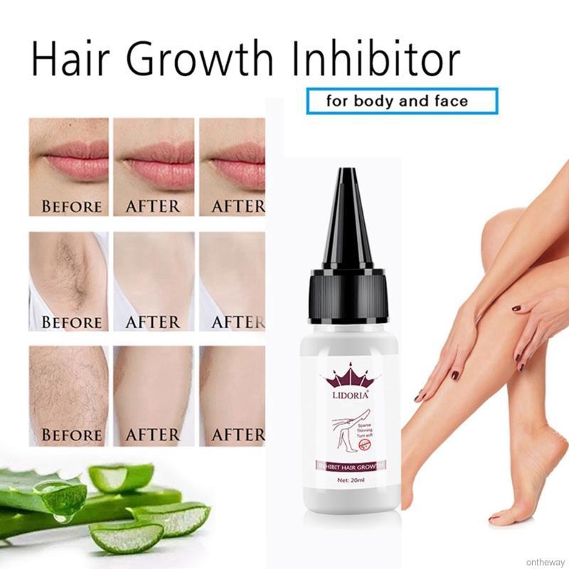 [Hàng mới về] Tinh chất ức chế mọc tóc sửa chữa 20ml | BigBuy360 - bigbuy360.vn