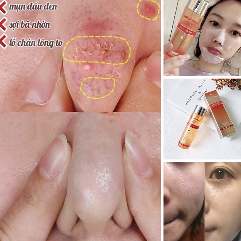 Nhật Bản Nước hoa hồng Dr.Ci Labo Labo Super Keana Lotion 100ml, Giảm Mụn, Se Khít Lỗ Chân Lông, Toner Cho Da Dầu