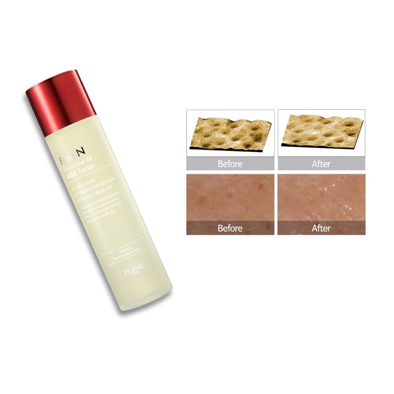 Nước Hoa Hồng Sạch Nhờn The Plant Base Pore N-Over 28 ABA Toner | BigBuy360 - bigbuy360.vn