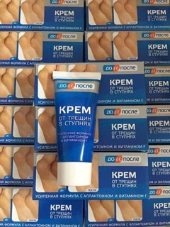Kem trị nứt gót chân Kpem Nga