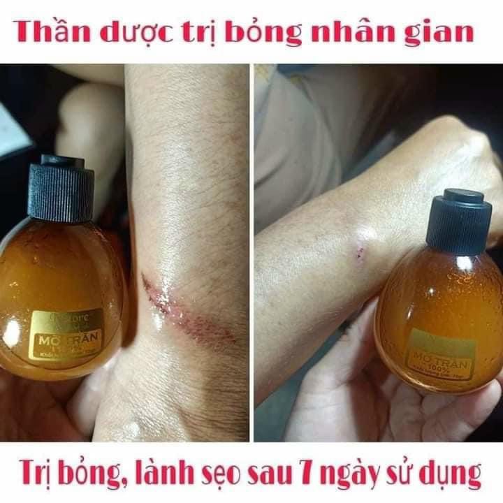 Mỡ Trăn Nguyên Chất N’store-Triệt Lông, Lành Vết Bỏng, Mờ Rạn Da, Nứt Gót Chân