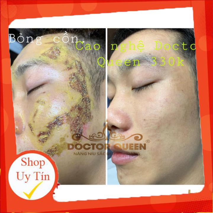 CAO NGHỆ DOCTORQUEEN 🔥𝐍𝐄𝐖🔥