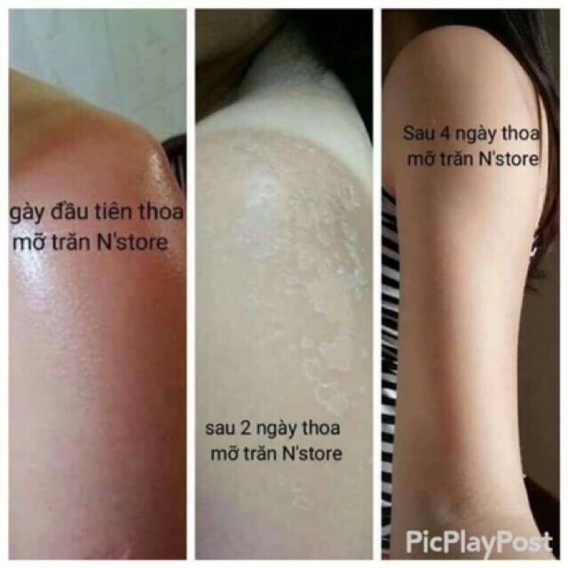 Mỡ trăn , MỠ TRĂN N’STORE MỠ TRĂNG NGUYÊN CHẤT N’STORE date mới [Hàng chính hãng mẫu mới có hộp] | BigBuy360 - bigbuy360.vn