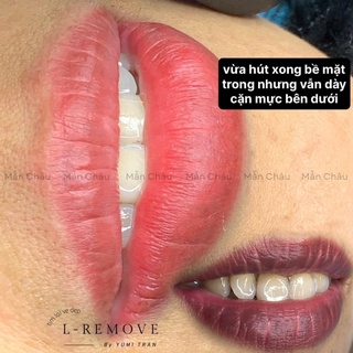 Dung Dịch Xóa Mực LRemove Chai Full 10ML