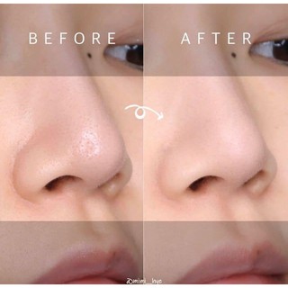 THANH LĂN MỤN ĐẦU ĐEN CLEAR STICK