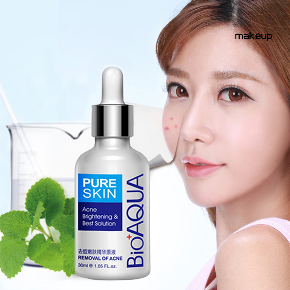 (Hàng Mới Về) Tinh Chất Trị Mụn Kiềm Dầu Dưỡng Ẩm Chăm Sóc Da Bioaqua 30ml