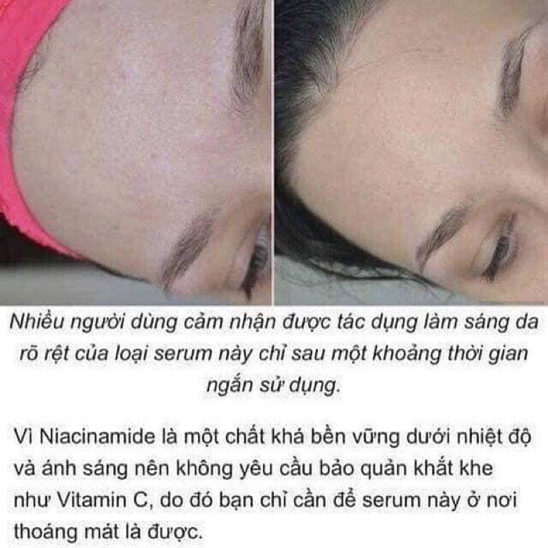 [Mã COS1904 giảm 8% đơn 300K] TINH CHẤT THE ORDINARY NIACINAMIDE 10%+ZINC 1% SERUM | BigBuy360 - bigbuy360.vn