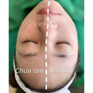 Tinh chất C.ấ.y phấn trắng da Hàn Quốc BB Dr Solution Dermamax lọ 8ml