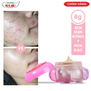 Kem mụn Hoa Đào 8g – Dưỡng da hiệu quả sau 2 tuần