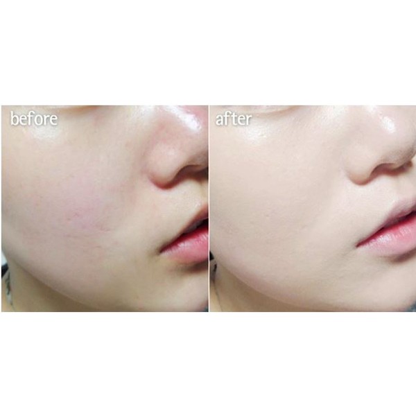 Hộp 4 ống serum eldas