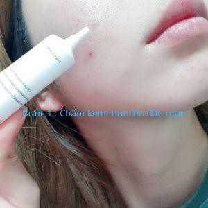 Bộ ngừa mụn trứng cá Repair Skin Kit nhập khẩu chính hãng Hàn Quốc